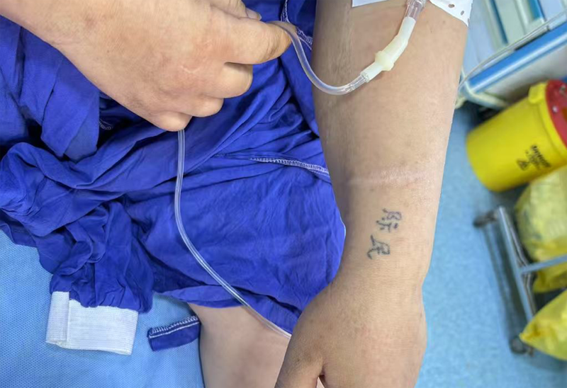 患者刺著漢字“際民”的左手手臂。中國援阿爾及利亞醫(yī)療隊(duì)供圖